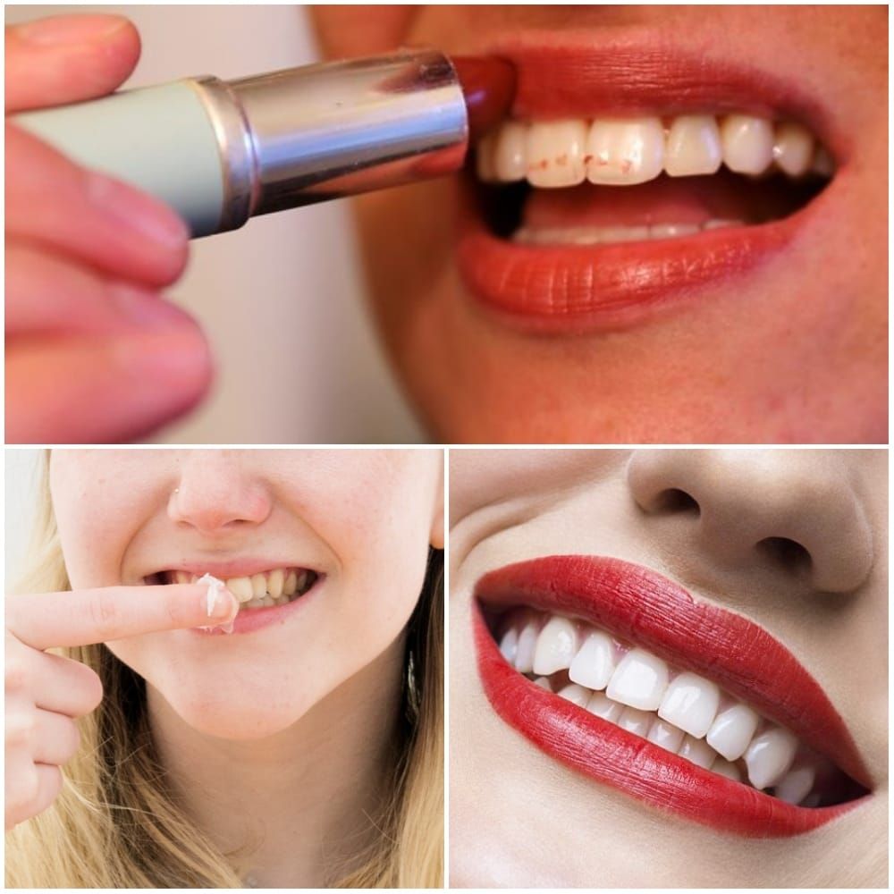 No More Lipstick on Your Teeth
