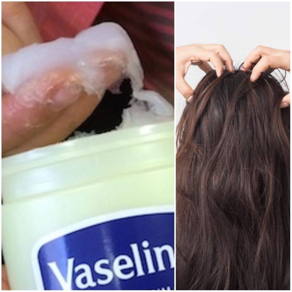 Lose and Prevent Dandruff